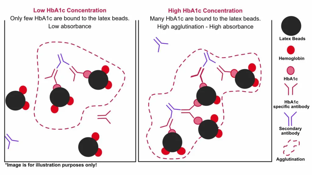 Illustration of HbA1c detection via latex agglutination: Comparison between low and high HbA1c concentrations showing degree of agglutination and absorbance levels based on antibody binding to latex beads.