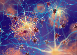 Colorful 3D illustration of neural networks with tau protein tangles—depicting the pathological targets of Nagase’s Anti-Tau Antibody for dementia research (RUO), supporting advanced studies in Alzheimer’s disease and neurodegeneration.