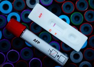 AFP rapid test kit and blood sample tube with red cap, representing Nagase AFP Antibodies for IVD diagnostics, enabling accurate detection and reliable cancer biomarker testing.